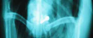 Loon X-ray showing sinker Loon X-ray showing sinker